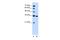 Solute Carrier Family 25 Member 29 antibody, A11796, Boster Biological Technology, Western Blot image 