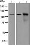 Nucleoporin 98 antibody, ab124980, Abcam, Western Blot image 