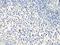 Metastasis Associated 1 Family Member 2 antibody, LS-C746863, Lifespan Biosciences, Immunohistochemistry frozen image 
