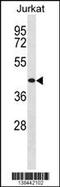 Thyrotropin Releasing Hormone Receptor antibody, 59-858, ProSci, Western Blot image 