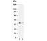 Arginase 1 antibody, R30878, NSJ Bioreagents, Western Blot image 