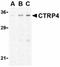 Complement C1q tumor necrosis factor-related protein 4 antibody, orb74637, Biorbyt, Western Blot image 