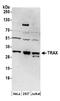 Translin Associated Factor X antibody, A304-538A, Bethyl Labs, Western Blot image 