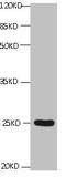 CD59 Molecule (CD59 Blood Group) antibody, CSB-MA0049471A0m, Cusabio, Western Blot image 