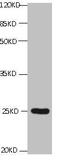 CD59 Molecule (CD59 Blood Group) antibody, CSB-MA0049471A0m, Cusabio, Western Blot image 