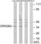 Olfactory Receptor Family 52 Subfamily B Member 2 antibody, abx015375, Abbexa, Western Blot image 