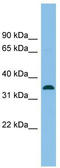 Serine Racemase antibody, TA344714, Origene, Western Blot image 