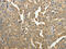 Proteasome 26S Subunit, Non-ATPase 9 antibody, CSB-PA576314, Cusabio, Immunohistochemistry paraffin image 