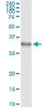 Distal-Less Homeobox 1 antibody, LS-C197056, Lifespan Biosciences, Immunoprecipitation image 