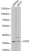 Caudal Type Homeobox 2 antibody, GTX32513, GeneTex, Western Blot image 