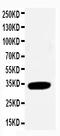 Cyclin Dependent Kinase 2 antibody, LS-C312706, Lifespan Biosciences, Western Blot image 