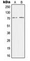 Mediator Complex Subunit 26 antibody, LS-C353168, Lifespan Biosciences, Western Blot image 