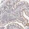 Myomesin 3 antibody, NBP1-81960, Novus Biologicals, Immunohistochemistry frozen image 