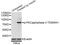 Protein Kinase C Beta antibody, STJ22341, St John