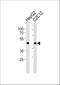 SMAD Family Member 3 antibody, A00059, Boster Biological Technology, Western Blot image 