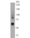 Mucolipin 3 antibody, NBP2-80438, Novus Biologicals, Western Blot image 
