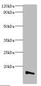 Transmembrane Protein 14B antibody, A57878-100, Epigentek, Western Blot image 