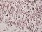 Zinc Finger Protein 174 antibody, A13957-1, Boster Biological Technology, Immunohistochemistry frozen image 