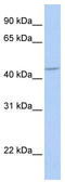 Gamma-Aminobutyric Acid Type A Receptor Alpha5 Subunit antibody, TA338504, Origene, Western Blot image 