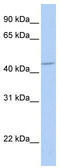 Gamma-Aminobutyric Acid Type A Receptor Alpha5 Subunit antibody, TA338504, Origene, Western Blot image 