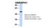 Heterogeneous Nuclear Ribonucleoprotein H1 antibody, 27-173, ProSci, Western Blot image 