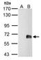 Zinc Finger Protein 703 antibody, NBP2-21043, Novus Biologicals, Western Blot image 