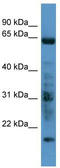 G Protein-Coupled Receptor Kinase 7 antibody, TA342751, Origene, Western Blot image 