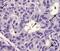 Survivin antibody, 14-9176-80, Invitrogen Antibodies, Immunohistochemistry paraffin image 