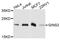 GINS Complex Subunit 2 antibody, A9172, ABclonal Technology, Western Blot image 