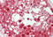 Spindlin 1 antibody, ARP52248_P050, Aviva Systems Biology, Immunohistochemistry paraffin image 