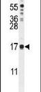 IQ Motif Containing J antibody, PA5-24393, Invitrogen Antibodies, Western Blot image 
