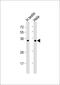 Boule Homolog, RNA Binding Protein antibody, 58-408, ProSci, Western Blot image 
