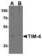 T Cell Immunoglobulin And Mucin Domain Containing 4 antibody, NBP1-76702, Novus Biologicals, Western Blot image 
