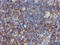 N-Myristoyltransferase 2 antibody, LS-C173684, Lifespan Biosciences, Immunohistochemistry paraffin image 