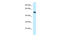 Vacuolar Protein Sorting 4 Homolog B antibody, ARP61680_P050, Aviva Systems Biology, Western Blot image 