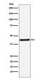 Homeobox A5 antibody, M04018, Boster Biological Technology, Western Blot image 