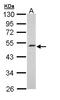 Chromosome 17 Open Reading Frame 75 antibody, LS-C186025, Lifespan Biosciences, Western Blot image 