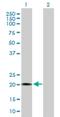 RB Binding Protein 9, Serine Hydrolase antibody, H00010741-B01P, Novus Biologicals, Western Blot image 