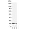 IL-4 antibody, R30605, NSJ Bioreagents, Western Blot image 