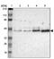 Alpha-N-Acetylgalactosaminidase antibody, PA5-51433, Invitrogen Antibodies, Western Blot image 