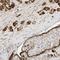 Protein Tyrosine Kinase 6 antibody, HPA036070, Atlas Antibodies, Immunohistochemistry paraffin image 