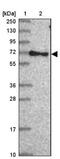 Rabaptin, RAB GTPase Binding Effector Protein 2 antibody, NBP2-13195, Novus Biologicals, Western Blot image 