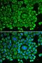 Rho GDP Dissociation Inhibitor Alpha antibody, LS-C331358, Lifespan Biosciences, Western Blot image 