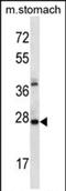 AlkB Homolog 4, Lysine Demethylase antibody, PA5-71747, Invitrogen Antibodies, Western Blot image 