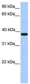 Meis Homeobox 1 antibody, TA335835, Origene, Western Blot image 