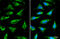 ADP/ATP translocase 3 antibody, GTX110983, GeneTex, Immunofluorescence image 