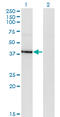 Histone Deacetylase 8 antibody, LS-C139403, Lifespan Biosciences, Western Blot image 