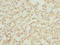 ArfGAP With SH3 Domain, Ankyrin Repeat And PH Domain 3 antibody, LS-C399827, Lifespan Biosciences, Immunohistochemistry paraffin image 