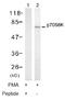 S6K antibody, AP02748PU-S, Origene, Western Blot image 