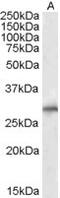 Siah E3 Ubiquitin Protein Ligase 1 antibody, EB05292, Everest Biotech, Western Blot image 